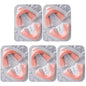Opalescence Go 6% Melon – Gutiere De Albire Gata De Utilizare